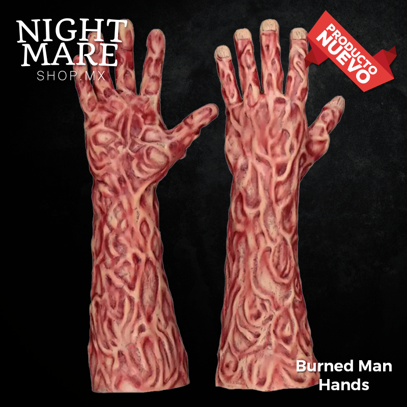 Burned Man Hands