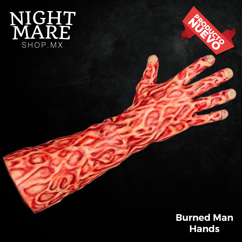 Burned Man Hands